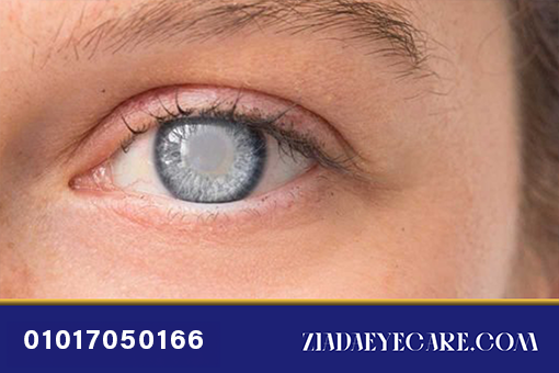 The blue water image